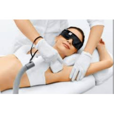 Лазерна епіляція